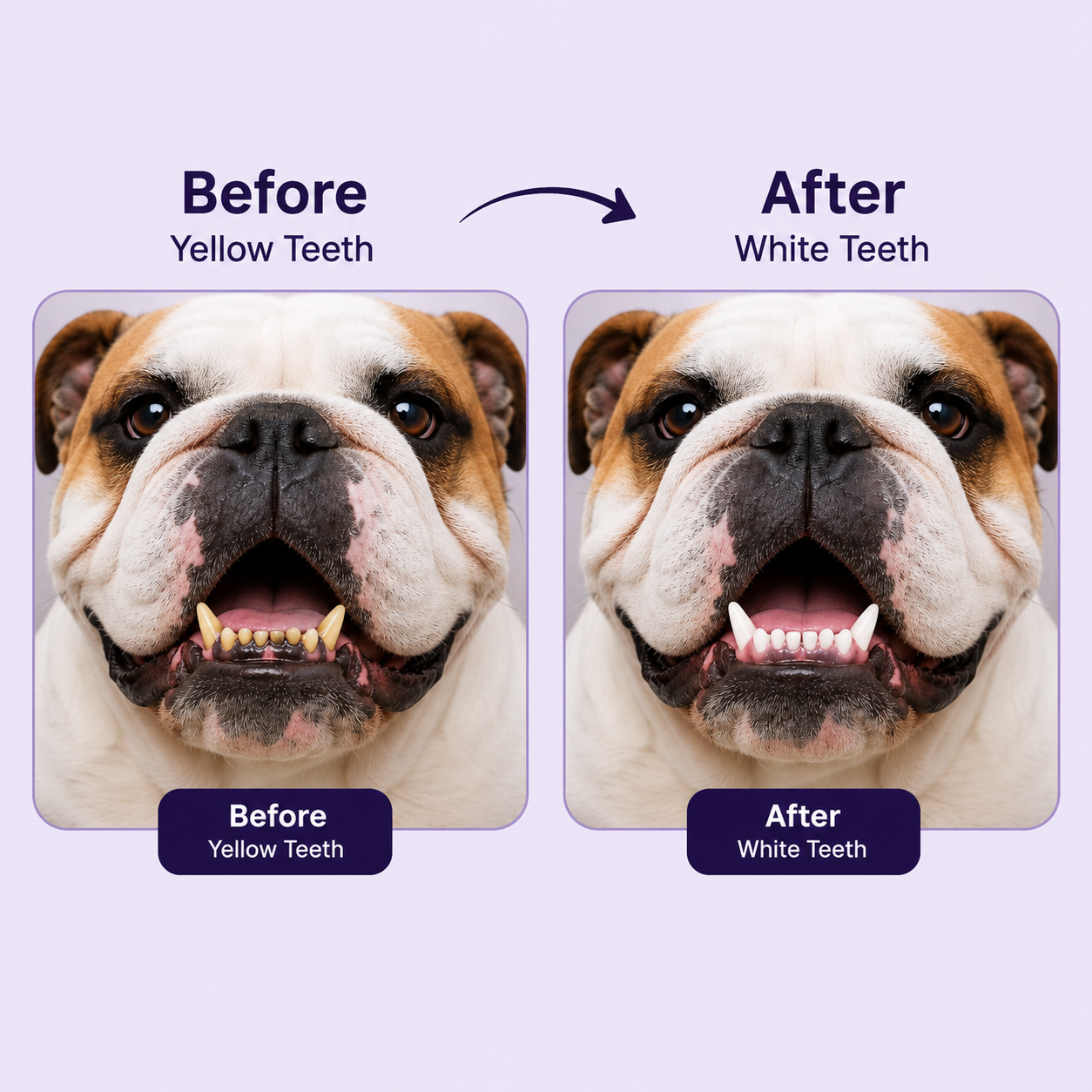 Before vs. after, yellow stained teeth to visibly whiter teeth